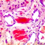 Amyloid Stain Kit