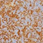 CD103 (RM) Antibody