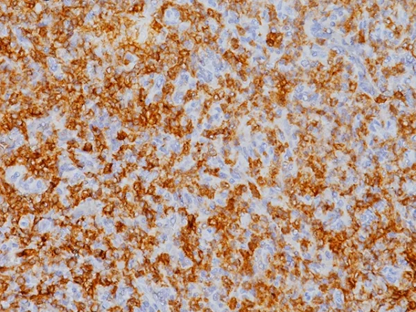 CD103 (RM) Antibody