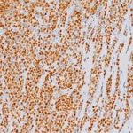 SOX11 antibody