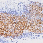 MASH 1 Antibody