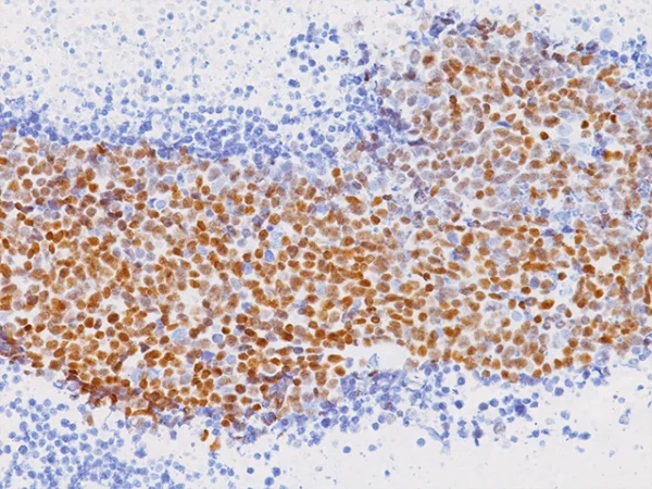 MASH 1 Antibody