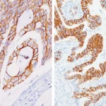 CDH17 (M) Antibody