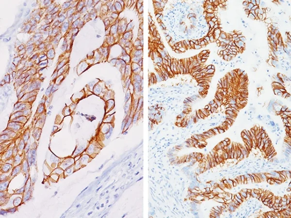 CDH17 (M) Antibody