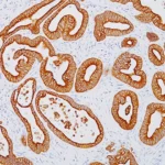 Cytokeratin 18 Antibody