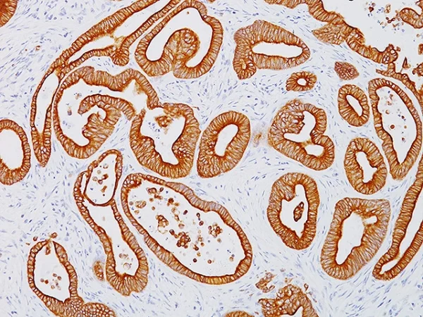 Cytokeratin 18 Antibody