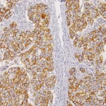 E-cadherin Antibody