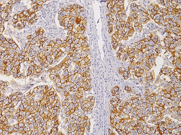 E-cadherin Antibody