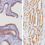 ERCC1 Antibody