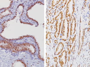 ERCC1 Antibody