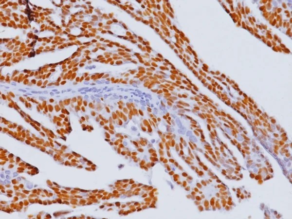 Estrogen Receptor