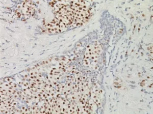 Estrogen Receptor (ER) [1D5]