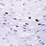 HPV 16 Antibody