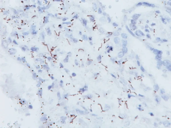 Spirochete (Polyclonal)