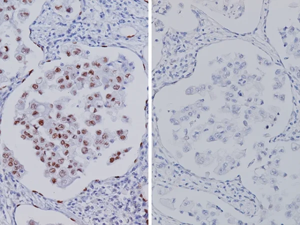 TTF-1 [SPT24] Antibody